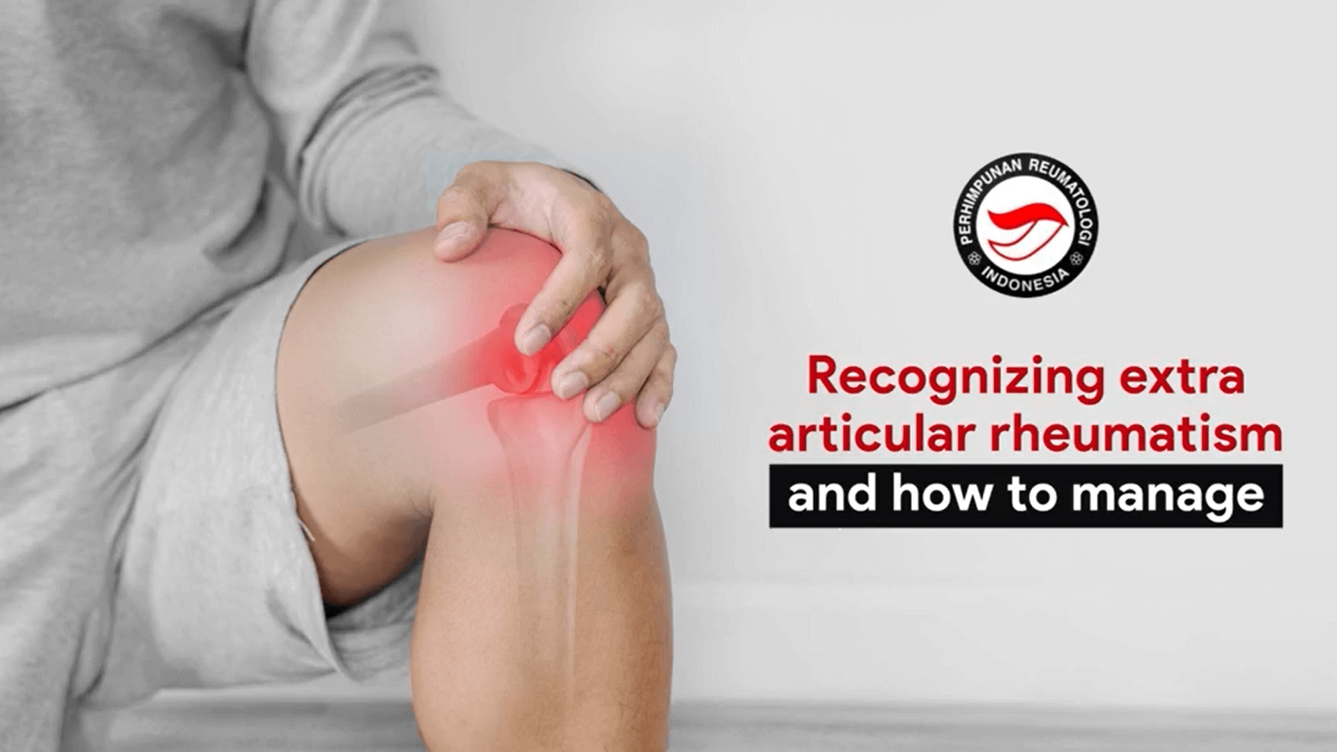 Recognizing Extra Articular Rheumatism and How to Manage – CME Reumatologi